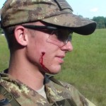 blessure airsoft